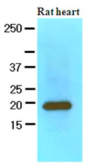 Western blot - Anti-Myosin Light Chain 2 antibody [AT3B2] (AB89594)