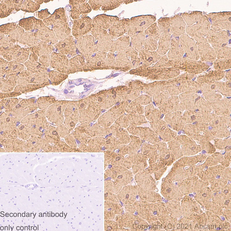 Immunohistochemistry (Formalin/PFA-fixed paraffin-embedded sections) - Anti-Myosin Light Chain 2 antibody [EPR3741] (AB92721)