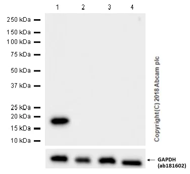 Western blot - Anti-Myosin Light Chain 2 antibody [EPR3741] (AB92721)