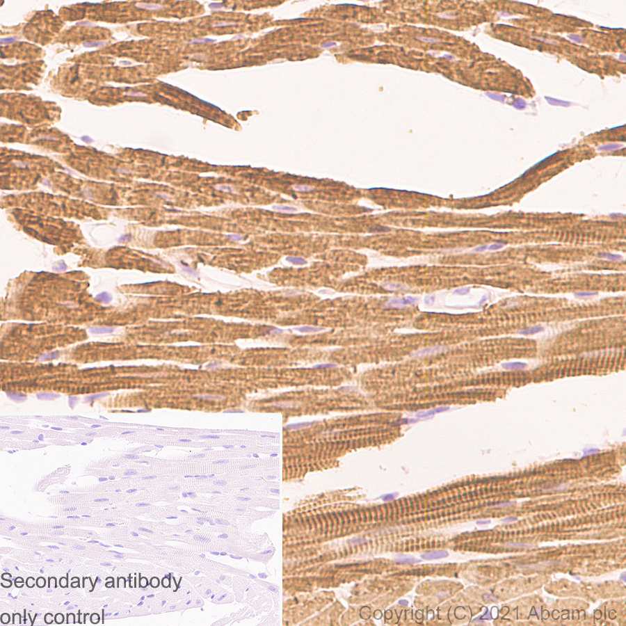 Immunohistochemistry (Formalin/PFA-fixed paraffin-embedded sections) - Anti-Myosin Light Chain 2 antibody [EPR3741] - BSA and Azide free (AB183490), expandable thumbnail