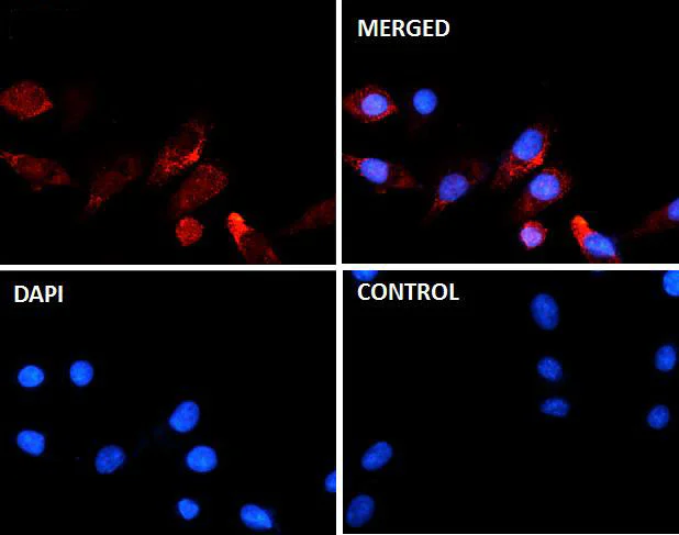 Immunocytochemistry/ Immunofluorescence - Anti-Myosin Light Chain 2 (phospho T18 + S19) antibody [SR4358] (AB326680)