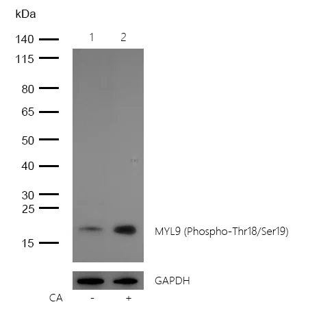 Western blot - Anti-Myosin Light Chain 2 (phospho T18 + S19) antibody [SR4358] (AB326680)