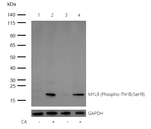 Western blot - Anti-Myosin Light Chain 2 (phospho T18 + S19) antibody [SR4358] (AB326680)