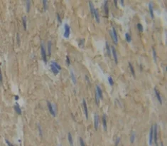 Immunohistochemistry (Formalin/PFA-fixed paraffin-embedded sections) - Anti-Myosin light chain 3 antibody (AB233220)