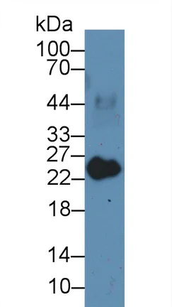 Western blot - Anti-Myosin light chain 3 antibody (AB233220)