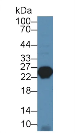 Western blot - Anti-Myosin light chain 3 antibody (AB233220)