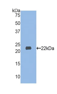 Western blot - Anti-Myosin light chain 3 antibody (AB233220)