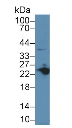 Western blot - Anti-Myosin light chain 3 antibody (AB233220)