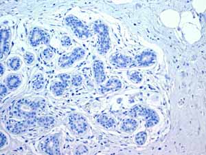 Immunohistochemistry (Formalin/PFA-fixed paraffin-embedded sections) - Anti-Myosin light chain 3 antibody [EPR4160] (ab108923), expandable thumbnail
