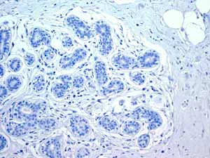 Immunohistochemistry (Formalin/PFA-fixed paraffin-embedded sections) - Anti-Myosin light chain 3 antibody [EPR4160] (AB108923)