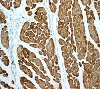 Immunohistochemistry (Formalin/PFA-fixed paraffin-embedded sections) - Anti-Myosin light chain 3 antibody [EPR4160] (AB108923), expandable thumbnail
