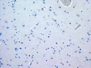 Immunohistochemistry (Formalin/PFA-fixed paraffin-embedded sections) - Anti-Myosin light chain 3 antibody [EPR4160] (AB108923), expandable thumbnail