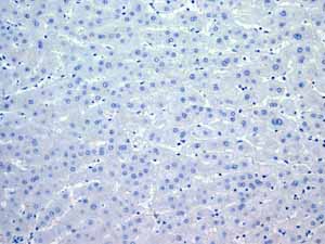 Immunohistochemistry (Formalin/PFA-fixed paraffin-embedded sections) - Anti-Myosin light chain 3 antibody [EPR4160] (AB108923), expandable thumbnail