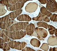 Immunohistochemistry (Formalin/PFA-fixed paraffin-embedded sections) - Anti-Myosin light chain 3 antibody [EPR4160] (AB108923), expandable thumbnail