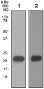 Western blot - Anti-Myosin light chain 3 antibody [EPR4160] (AB108923)