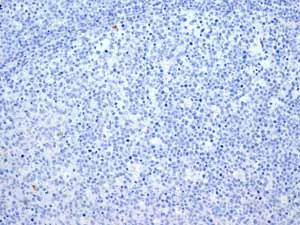 Immunohistochemistry (Formalin/PFA-fixed paraffin-embedded sections) - Anti-Myosin light chain 3 antibody [EPR4160] - BSA and Azide free (AB247710)