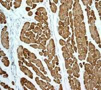 Immunohistochemistry (Formalin/PFA-fixed paraffin-embedded sections) - Anti-Myosin light chain 3 antibody [EPR4160] - BSA and Azide free (AB247710)