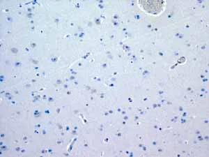 Immunohistochemistry (Formalin/PFA-fixed paraffin-embedded sections) - Anti-Myosin light chain 3 antibody [EPR4160] - BSA and Azide free (AB247710)