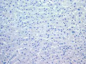 Immunohistochemistry (Formalin/PFA-fixed paraffin-embedded sections) - Anti-Myosin light chain 3 antibody [EPR4160] - BSA and Azide free (AB247710)