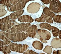 Immunohistochemistry (Formalin/PFA-fixed paraffin-embedded sections) - Anti-Myosin light chain 3 antibody [EPR4160] - BSA and Azide free (AB247710)