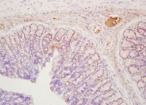 Immunohistochemistry (Formalin/PFA-fixed paraffin-embedded sections) - Anti-Myosin light chain kinase/MLCK antibody (AB203292)