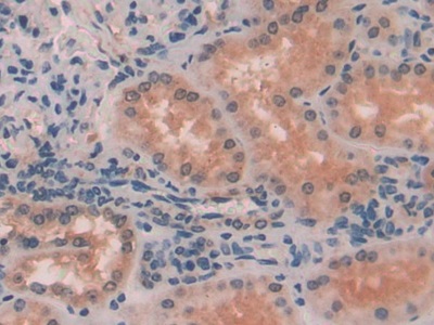 Immunohistochemistry (Formalin/PFA-fixed paraffin-embedded sections) - Anti-Myosin light chain kinase/MLCK antibody (AB232949)