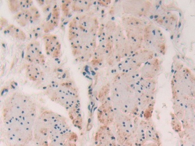 Immunohistochemistry (Formalin/PFA-fixed paraffin-embedded sections) - Anti-Myosin light chain kinase/MLCK antibody (AB232949)