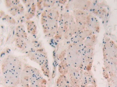 Immunohistochemistry (Formalin/PFA-fixed paraffin-embedded sections) - Anti-Myosin light chain kinase/MLCK antibody (AB232949)