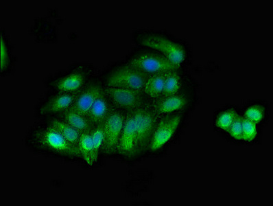 Immunocytochemistry/ Immunofluorescence - Anti-Myosin light chain kinase/MLCK antibody (AB236299)
