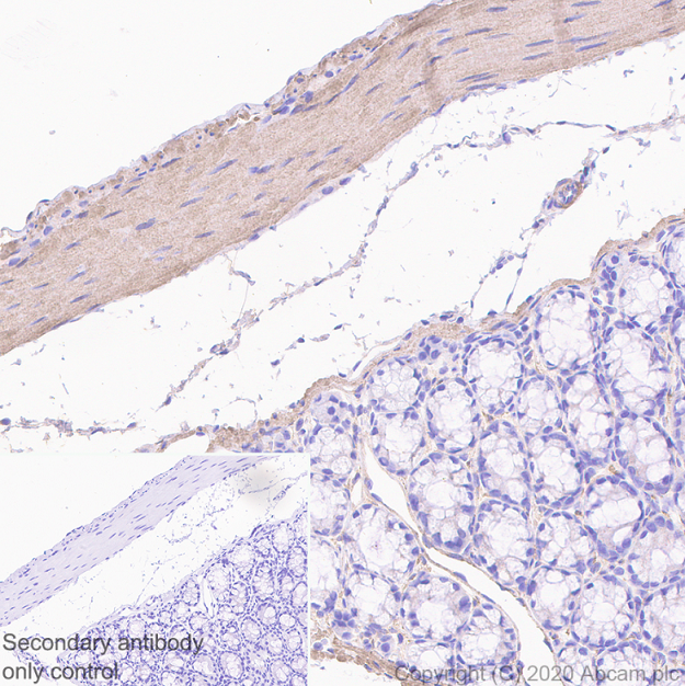 Immunohistochemistry (Formalin/PFA-fixed paraffin-embedded sections) - Anti-Myosin light chain kinase/MLCK antibody [EP1458Y] (AB76092), expandable thumbnail