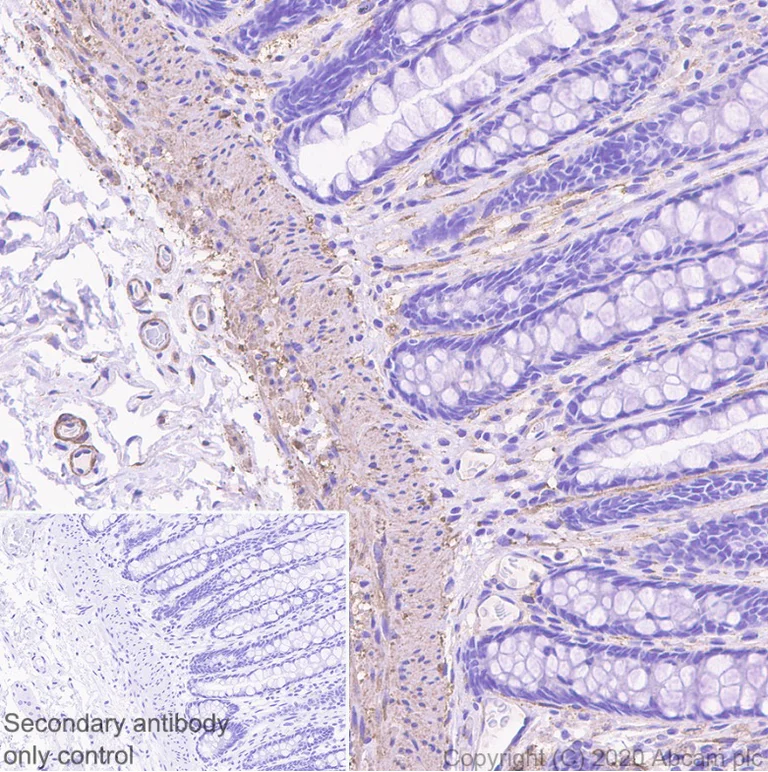 Immunohistochemistry (Formalin/PFA-fixed paraffin-embedded sections) - Anti-Myosin light chain kinase/MLCK antibody [EP1458Y] (AB76092)