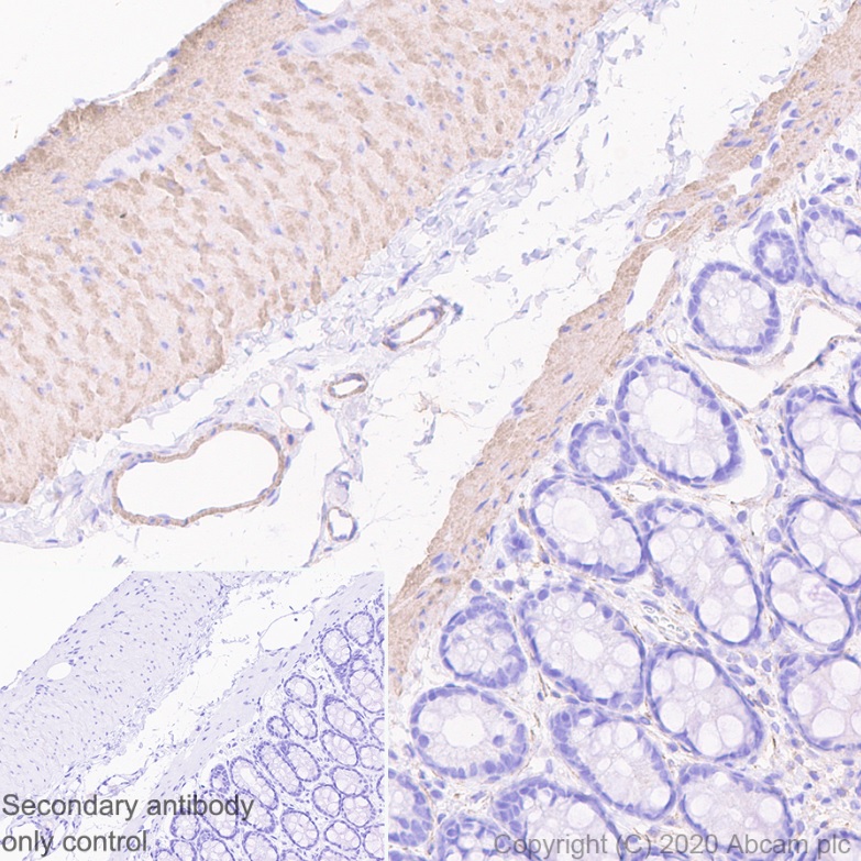 Immunohistochemistry (Formalin/PFA-fixed paraffin-embedded sections) - Anti-Myosin light chain kinase/MLCK antibody [EP1458Y] (AB76092), expandable thumbnail