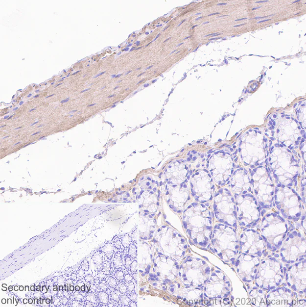 Immunohistochemistry (Formalin/PFA-fixed paraffin-embedded sections) - Anti-Myosin light chain kinase/MLCK antibody [EP1458Y] - BSA and Azide free (AB238429)