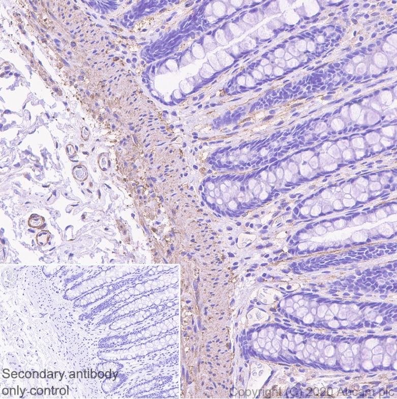 Immunohistochemistry (Formalin/PFA-fixed paraffin-embedded sections) - Anti-Myosin light chain kinase/MLCK antibody [EP1458Y] - BSA and Azide free (AB238429)