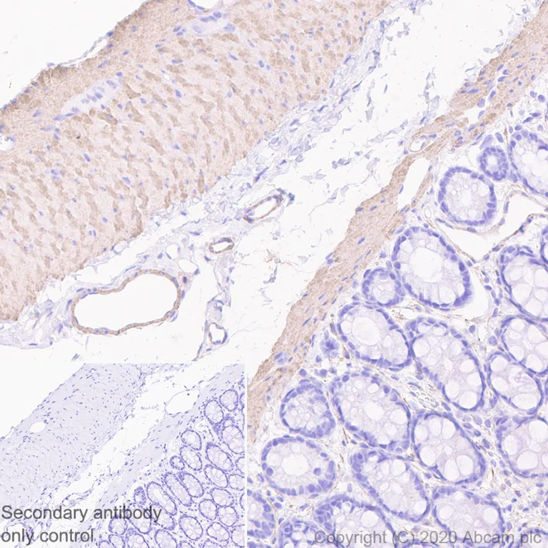 Immunohistochemistry (Formalin/PFA-fixed paraffin-embedded sections) - Anti-Myosin light chain kinase/MLCK antibody [EP1458Y] - BSA and Azide free (AB238429)