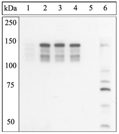 Western blot - Anti-Myosin light chain kinase/MLCK (phospho S1760) antibody (AB200809)