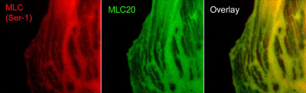 Immunocytochemistry/ Immunofluorescence - Anti-Myosin light chain (phospho S1) antibody (AB157747)
