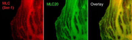 Immunocytochemistry/ Immunofluorescence - Anti-Myosin light chain (phospho S1) antibody (AB157747)