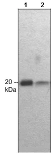 Western blot - Anti-Myosin light chain (phospho S1) antibody (AB157747)