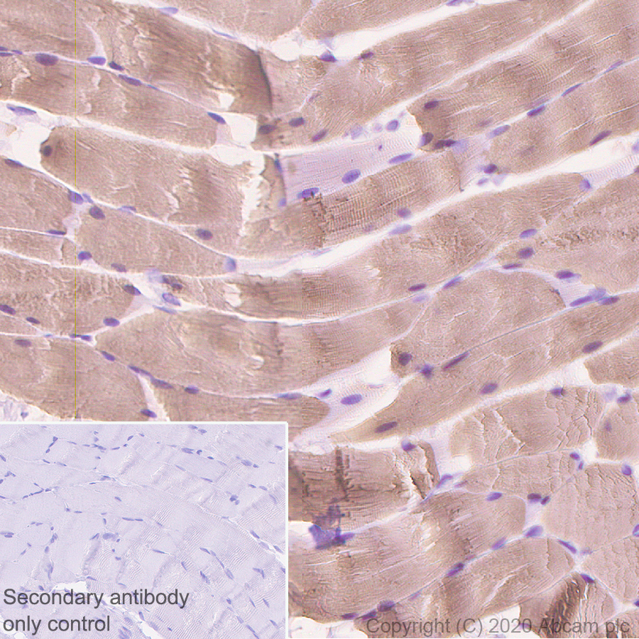 Immunohistochemistry (Formalin/PFA-fixed paraffin-embedded sections) - Anti-Myosin (MYH 1/2) antibody [A4.1025] (ab37484), expandable thumbnail