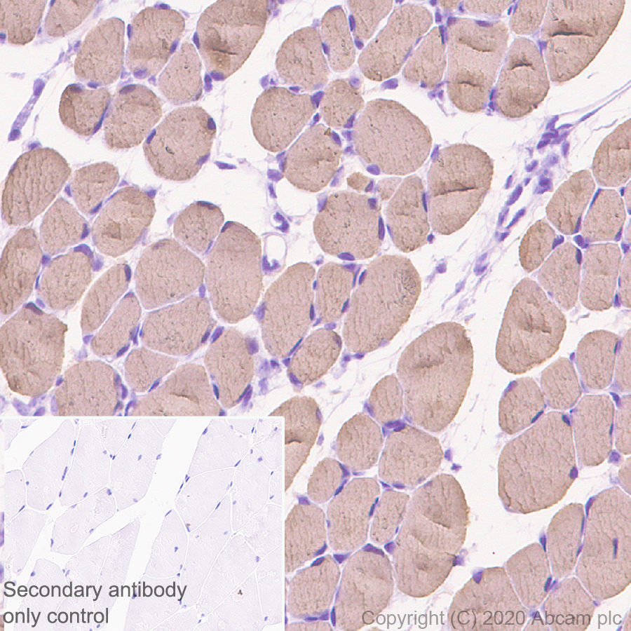 Immunohistochemistry (Formalin/PFA-fixed paraffin-embedded sections) - Anti-Myosin (MYH 1/2) antibody [A4.1025] (ab37484), expandable thumbnail