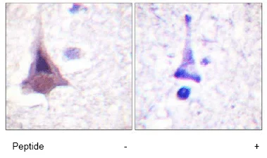 Immunohistochemistry (Formalin/PFA-fixed paraffin-embedded sections) - Anti-Myosin Phosphatase antibody (AB59235)