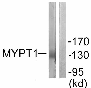Western blot - Anti-Myosin Phosphatase antibody (AB59235), expandable thumbnail