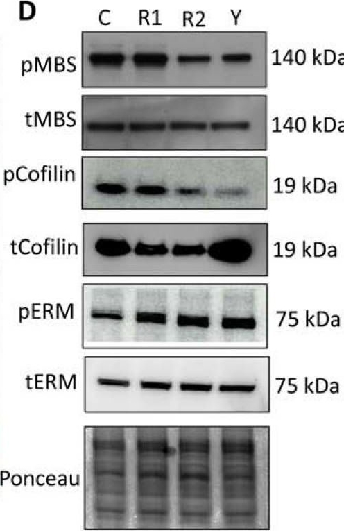 Western blot - Anti-Myosin Phosphatase antibody (AB59235), expandable thumbnail
