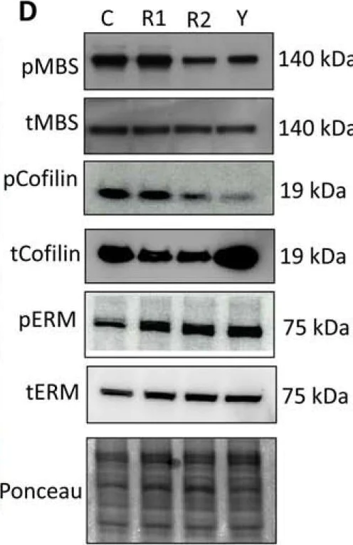 Western blot - Anti-Myosin Phosphatase antibody (AB59235)
