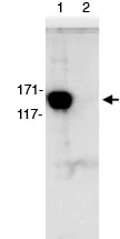 Immunoprecipitation - Anti-Myosin Phosphatase antibody (AB70809)