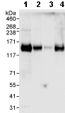 Western blot - Anti-Myosin Phosphatase antibody (AB70809)