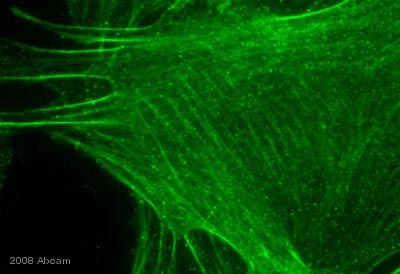 Anti-Myosin Phosphatase + Myosin Phosphatase 2 antibody [YE336]
