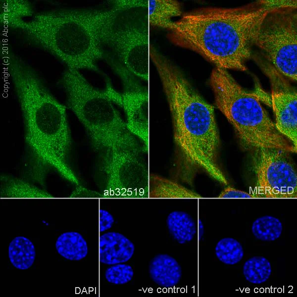 Immunocytochemistry/ Immunofluorescence - Anti-Myosin Phosphatase + Myosin Phosphatase 2 antibody [YE336] (AB32519)