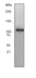 Western blot - Anti-Myosin Phosphatase + Myosin Phosphatase 2 antibody [YE336] (AB32519)